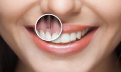 Имплантация зубов: возвращение к уверенной улыбке